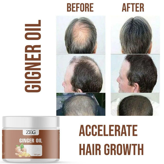 ZEG GINGER OIL 100% Natural Oil for Hair, Skin & Body