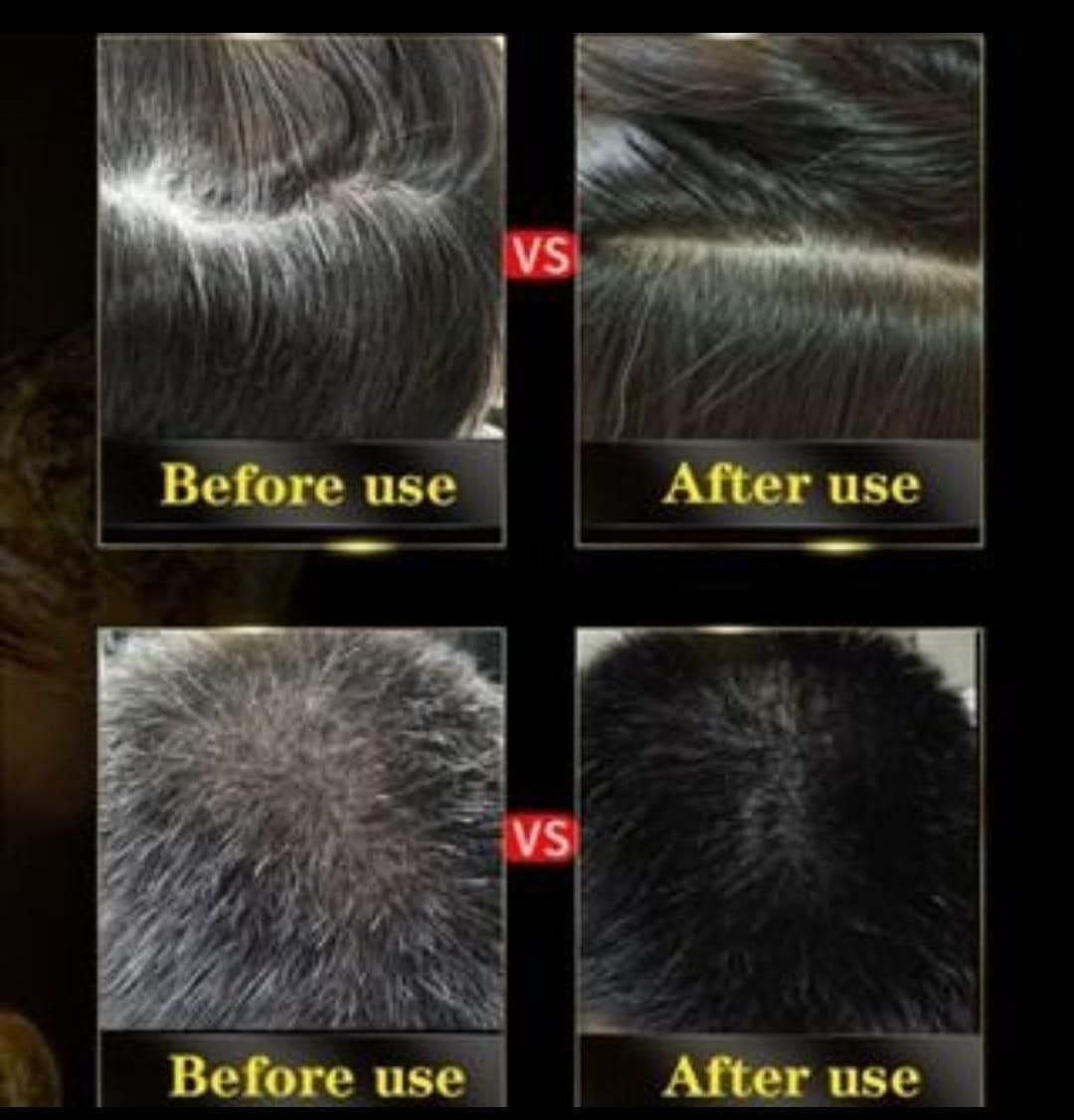 Herbal Instant Black Hair Shampoo – Grey Coverage + Shine Boost (2 Bottles)