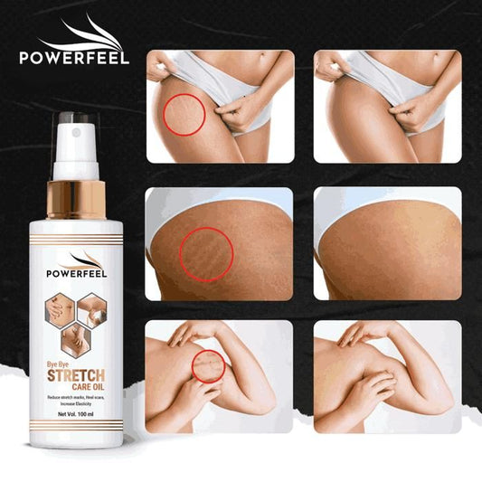 POWERFUL Stretch Mark Removal